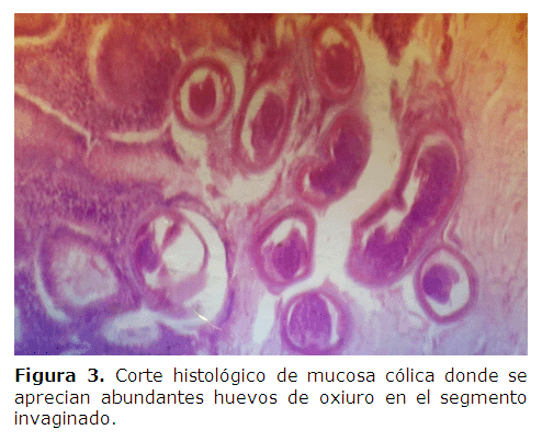 Oxiuros histologia. CARTE-LP-PEDIATRIE-print (1).pdf